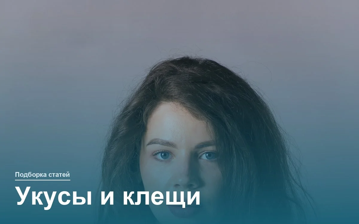 Укусы и клещи — что делать после